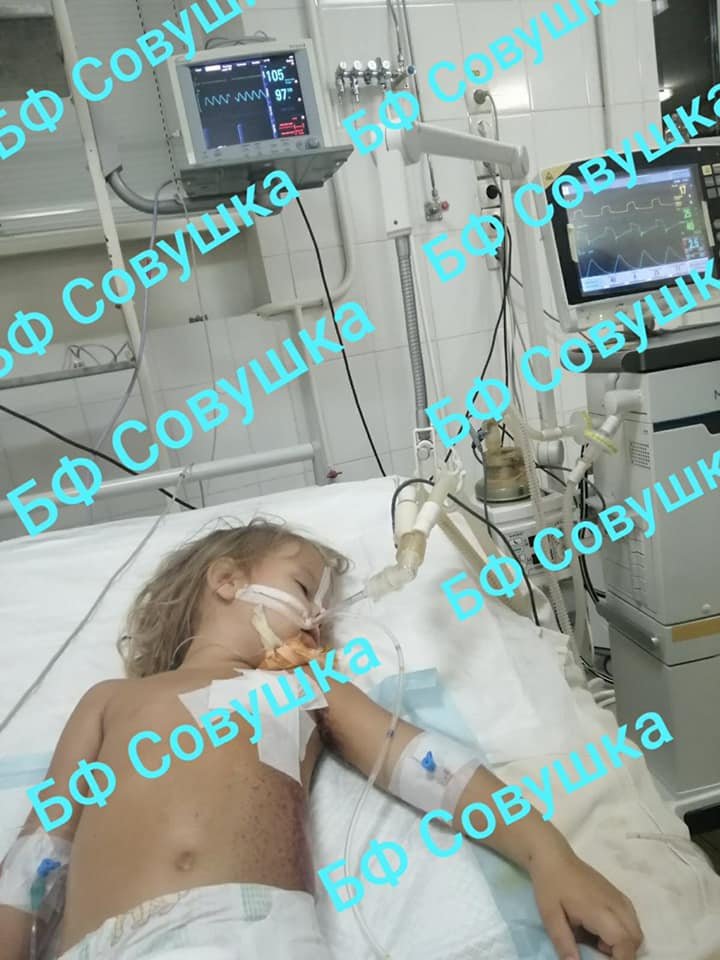 В Днепре спасают 4-летнюю девочку, которая выпала из окна на 5-м этаже 1
