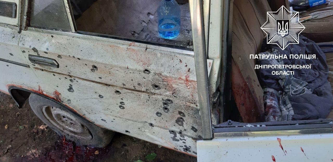 В результате взрыва ему оторвало обе руки В результате взрыва ему оторвало обе руки