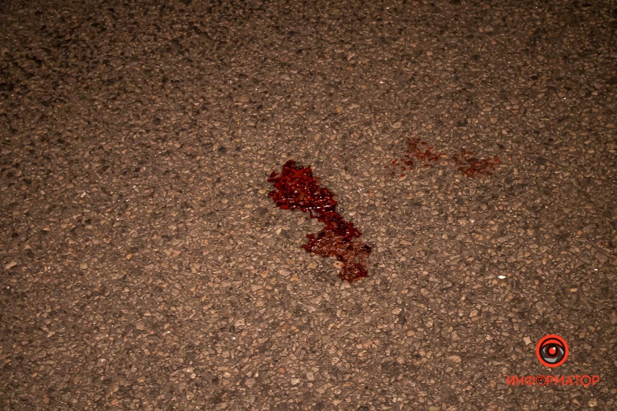 Велосипедист получил травмы Велосипедист получил травмы