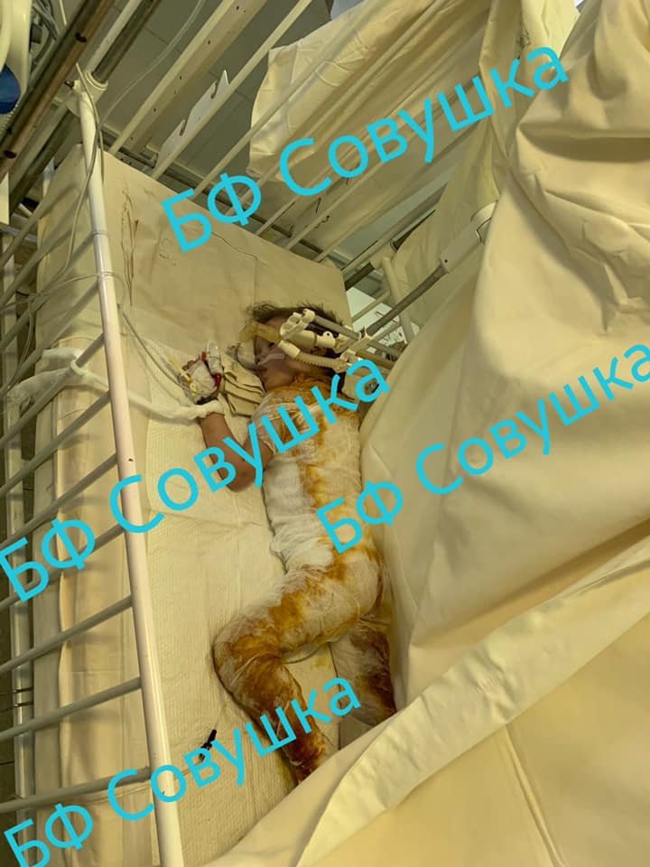 Сохраните жизнь: каким детям из Днепра нужна помощь 3