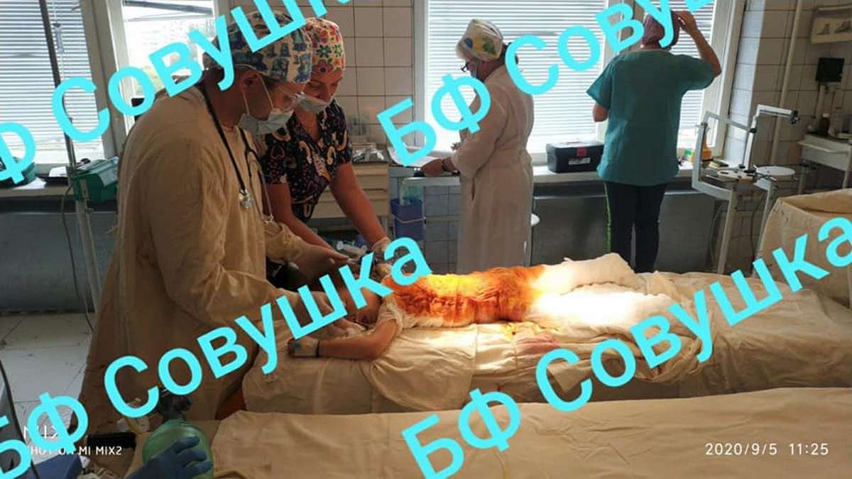 В Днепре врачи борются за жизнь 4-летней девочки, пострадавшей в пожаре: состояние ребенка 1