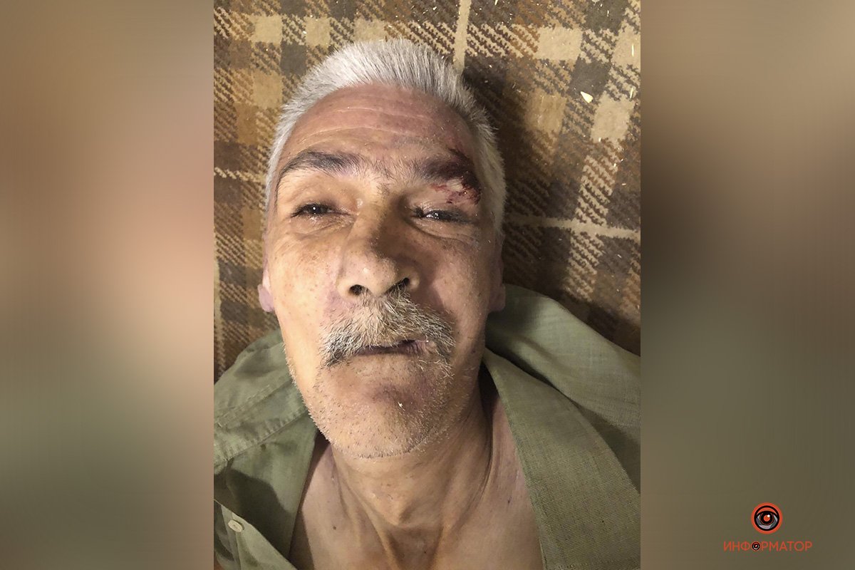 На вид мужчине 60-65 лет На вид мужчине 60-65 лет