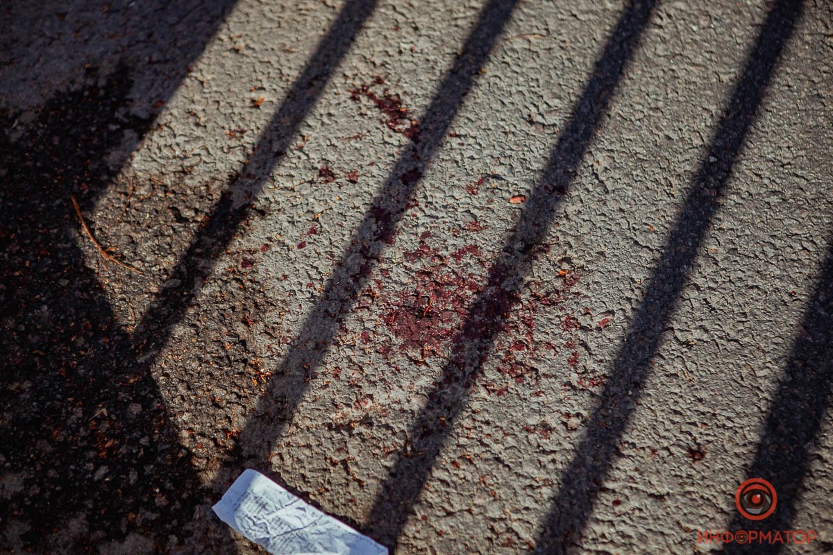 Тягач с полуприцепом зацепил ребенка Тягач с полуприцепом зацепил ребенка