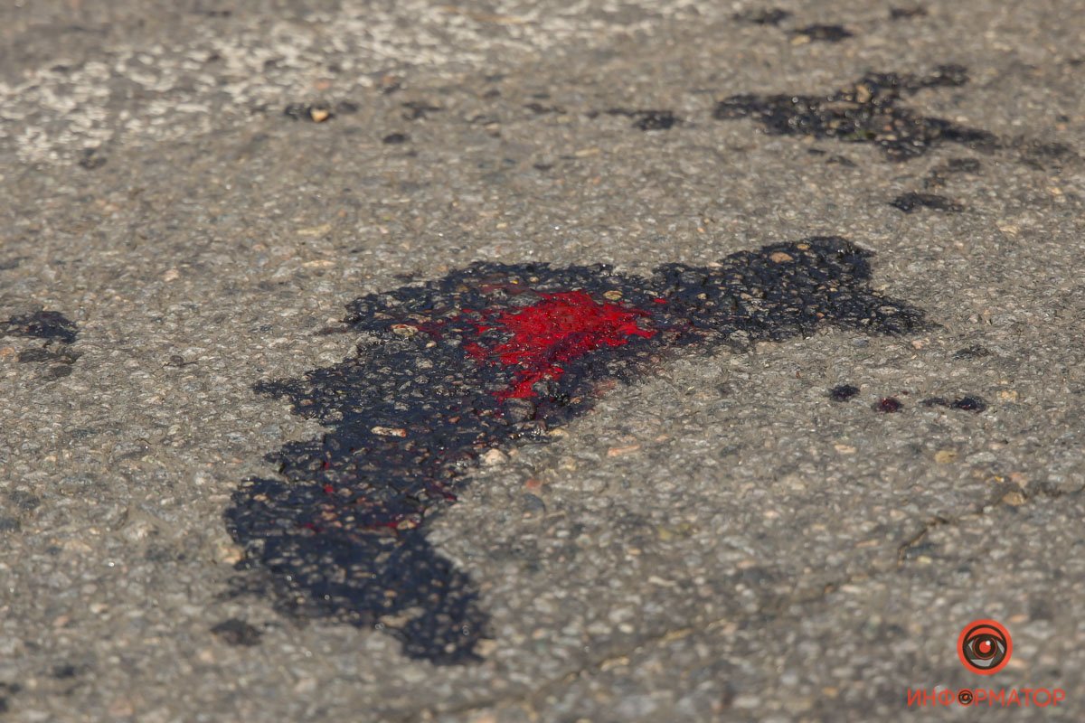 Она получила травмы головы и ноги Она получила травмы головы и ноги