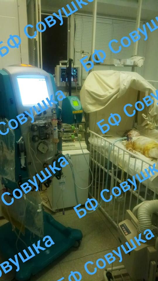 В Днепре продолжают бороться за жизнь 4-летней девочки, пострадавшей в пожаре 1