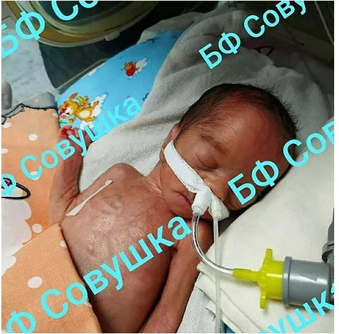 Мелена родилась преждевременно Мелена родилась преждевременно