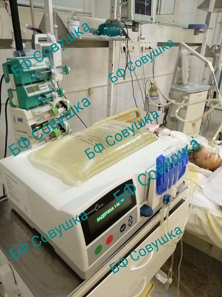 Состояние 2-летнего мальчика, которого покусали собаки, ухудшилось: ребенка подключили к аппарату искусственной почки 1