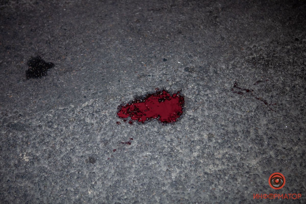 На велосипедисте не было шлема. При падении он получил закрытую черепно-мозговую травму На велосипедисте не было шлема. При падении он получил закрытую черепно-мозговую травму