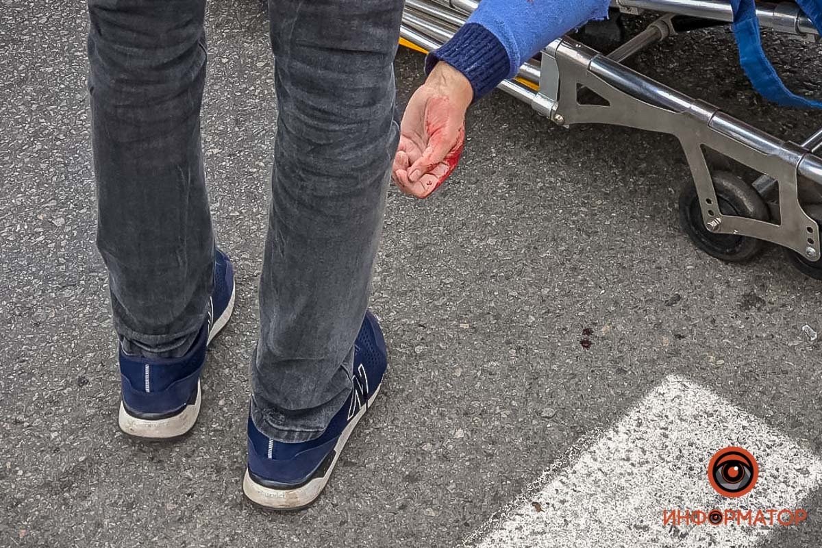 У женщины диагностировали ушиб головы 