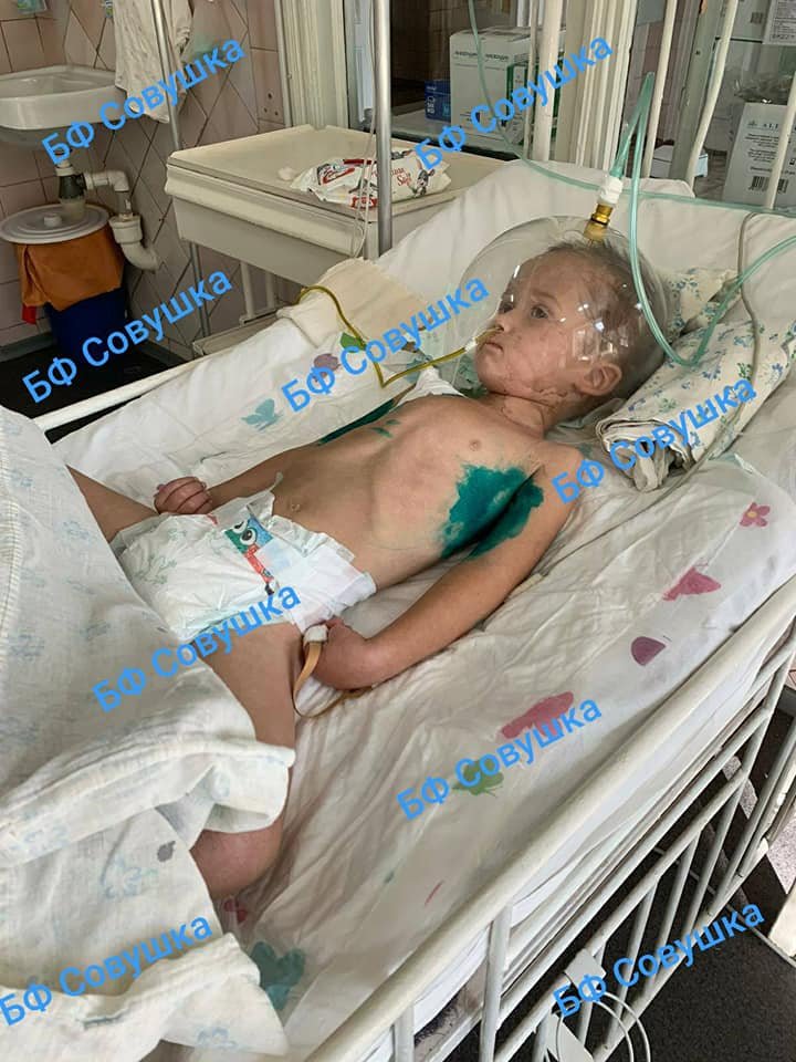 В больницу №6 в Днепре доставили "тяжелого" 3-летнего мальчика с коронавирусом В больницу №6 в Днепре доставили "тяжелого" 3-летнего мальчика с коронавирусом