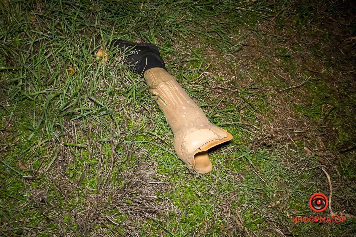 Водитель потерял протез Водитель потерял протез