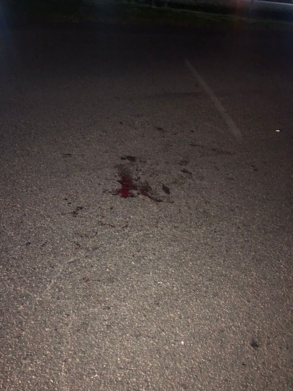 Пострадавшего госпитализировали Пострадавшего госпитализировали