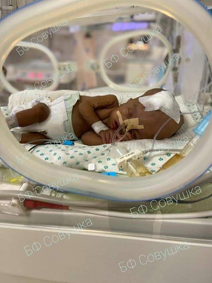 Опрокинул кипяток, упала с велосипеда и заболел коронавирусом: каким детям из Днепра нужна помощь 1