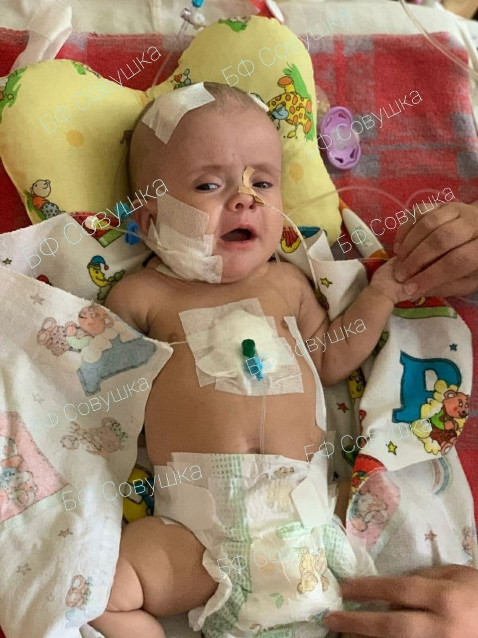 Опрокинул кипяток, упала с велосипеда и заболел коронавирусом: каким детям из Днепра нужна помощь 3