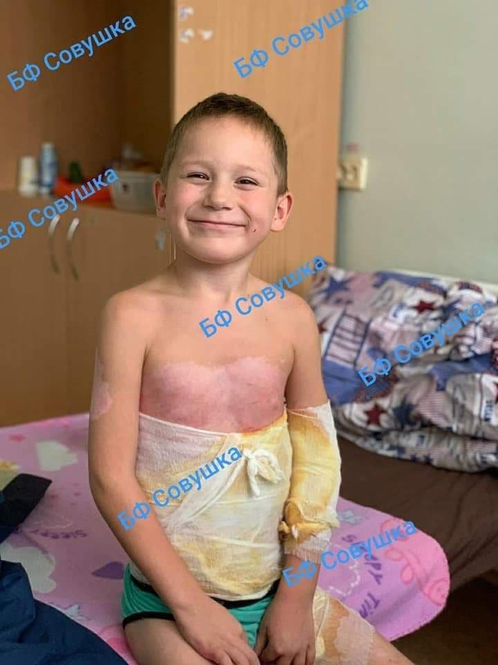 Опрокинул кипяток, упала с велосипеда и заболел коронавирусом: каким детям из Днепра нужна помощь 6