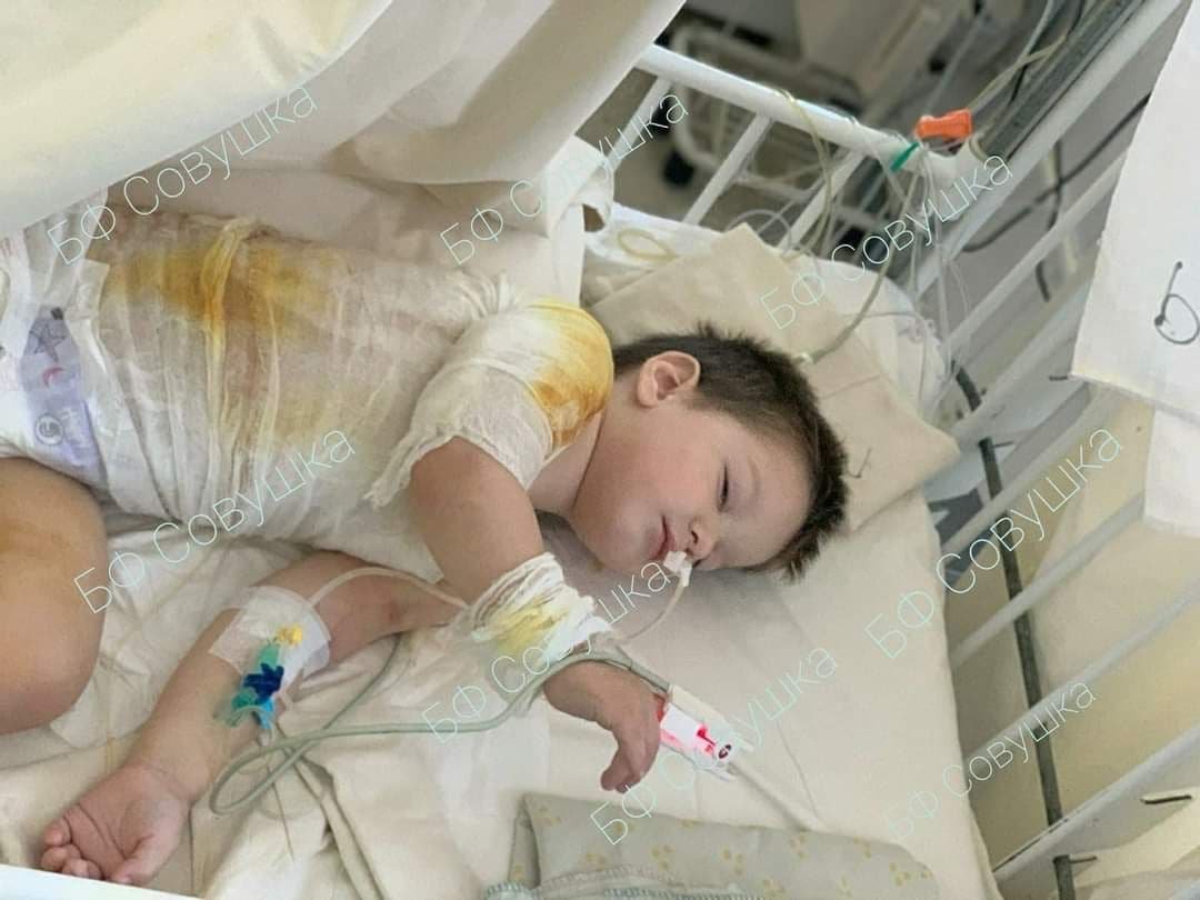 Опрокинул кипяток, упала с велосипеда и заболел коронавирусом: каким детям из Днепра нужна помощь 8