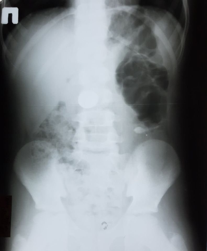 Монета Монета