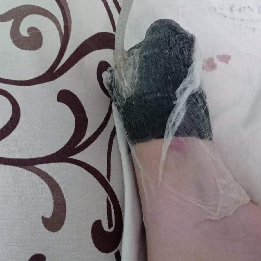 В Днепре, на жилмассиве Игрень, 10-летняя девочка сильно травмировала ногу во дворе школы: нужна помощь В Днепре, на жилмассиве Игрень, 10-летняя девочка сильно травмировала ногу во дворе школы: нужна помощь