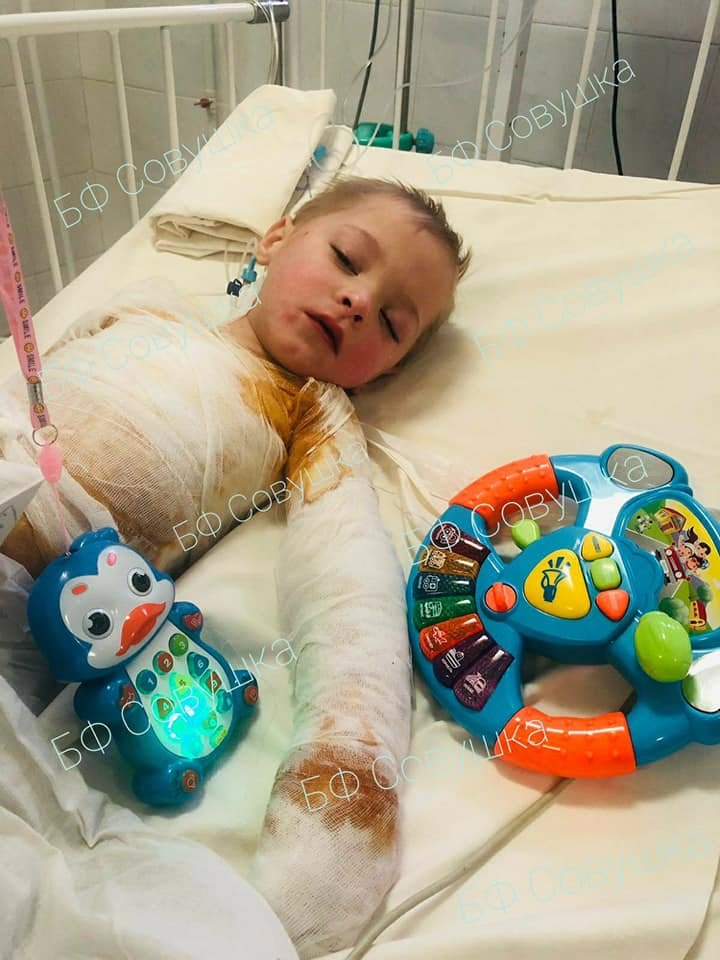 У Степы обожжено 25% тела У Степы обожжено 25% тела