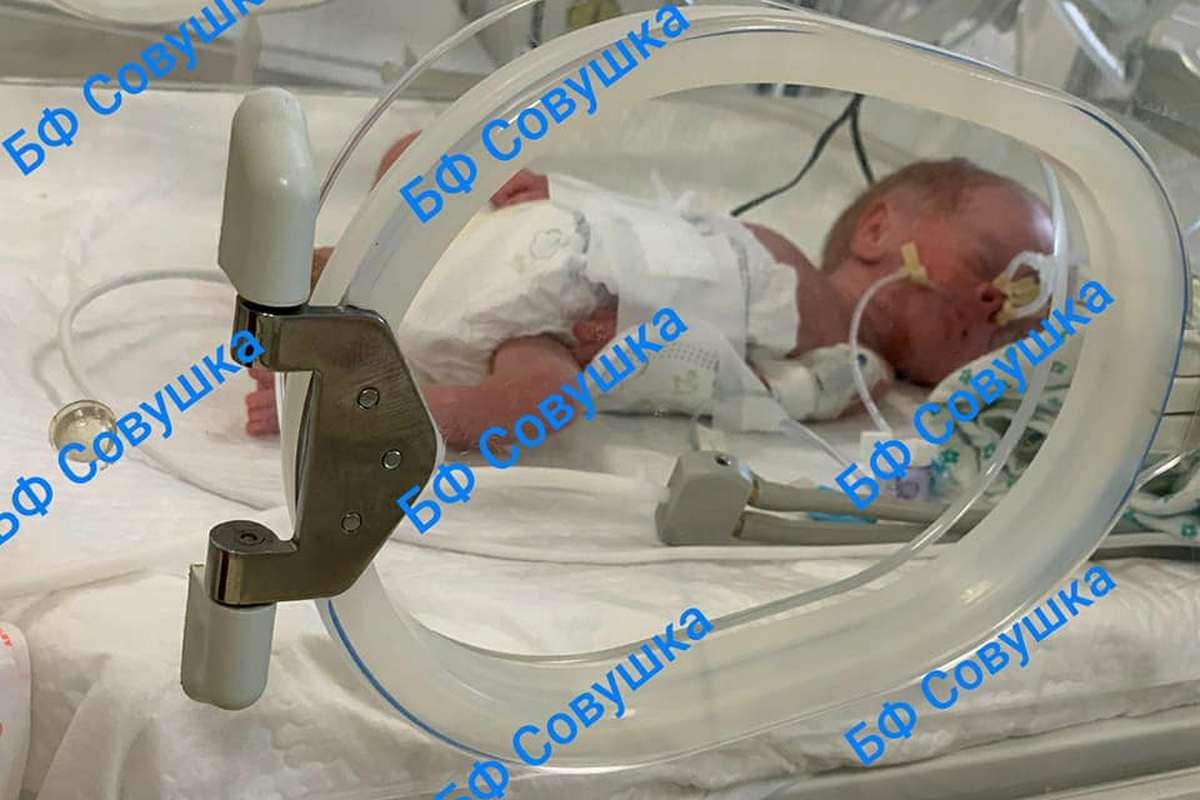 Кроха родилась с весом 710 грамм