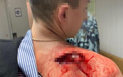 В результате драки в ресторане Черчилль работник заведения получил тяжелые телесные повреждения В результате драки в ресторане Черчилль работник заведения получил тяжелые телесные повреждения