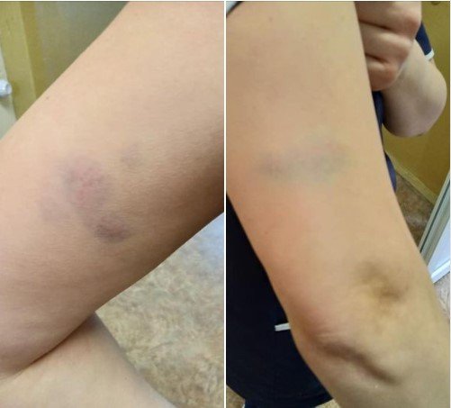 19 декабря, около 5:30, в городской больнице №7 города Каменского пациент напал на медработника