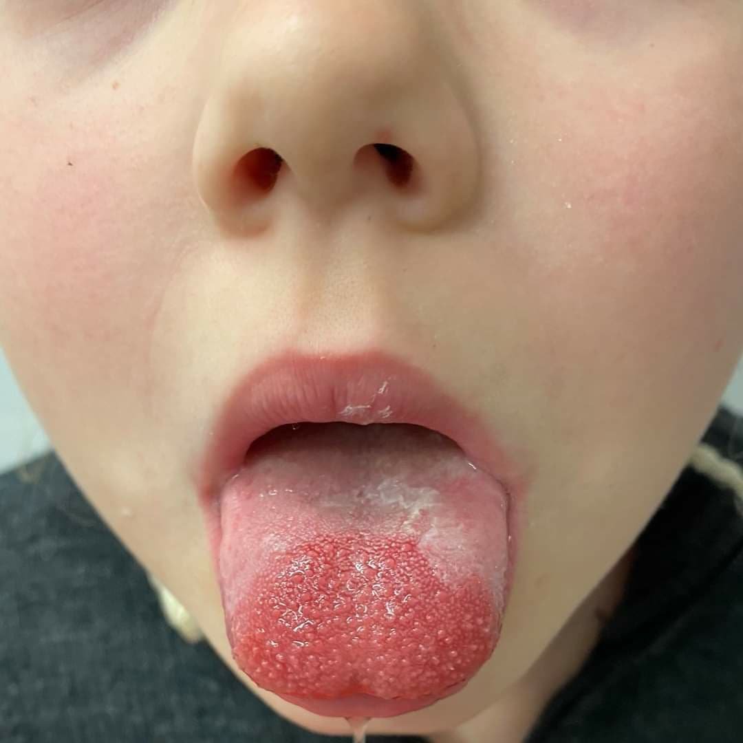 С ребенком все хорошо