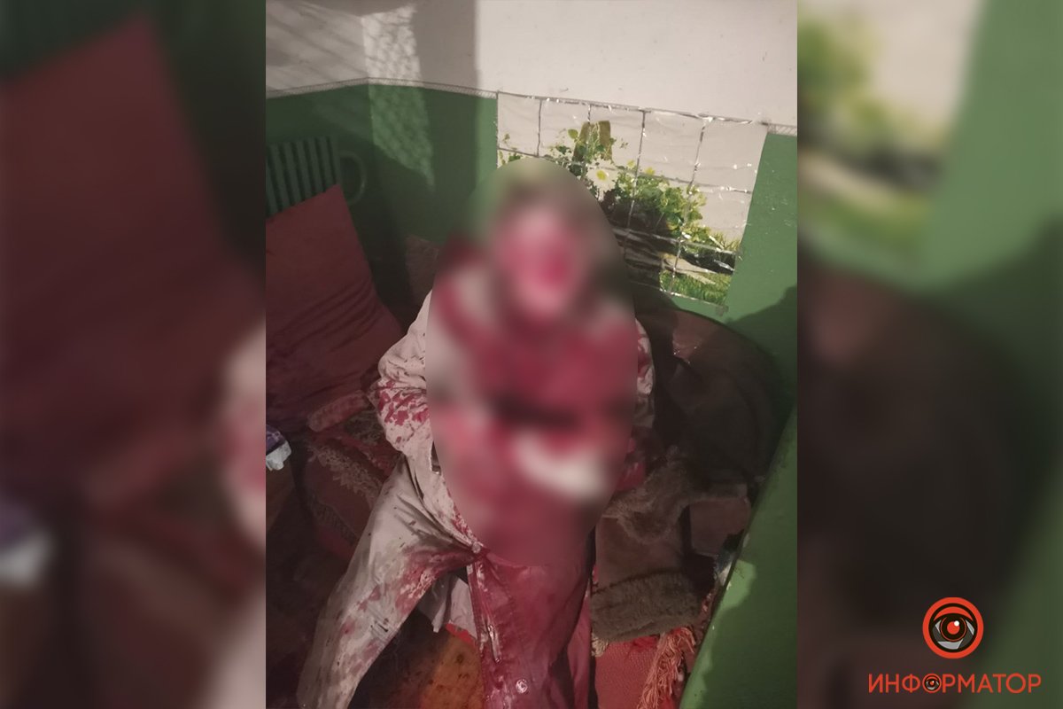 К счастью, она выжила