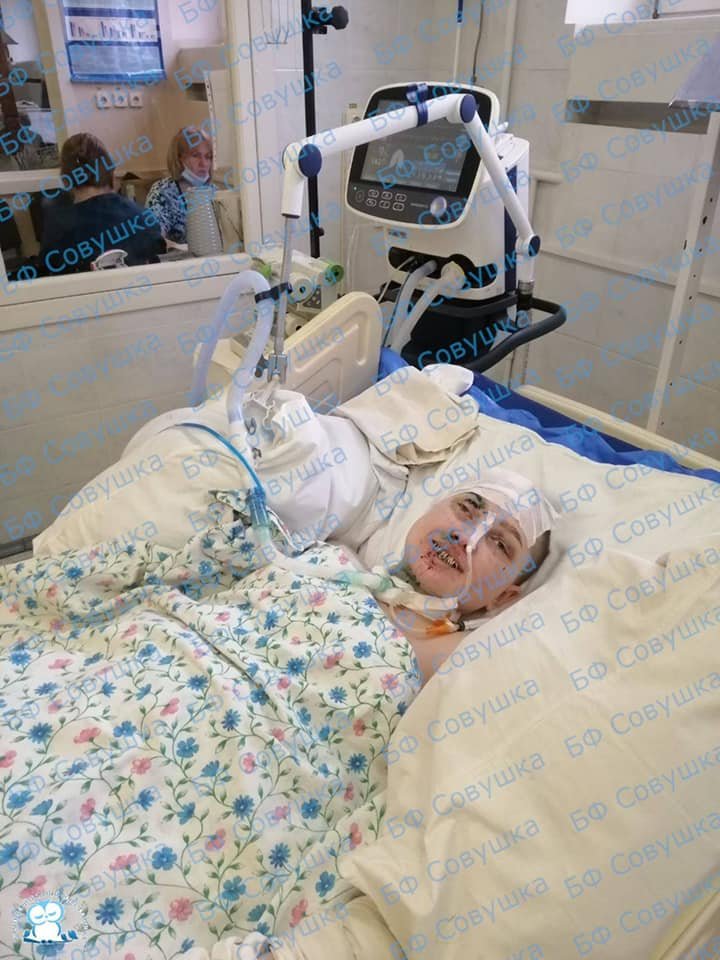 В детской больнице Днепра спасают "тяжелую" девочку, которая вылетела из авто через лобовое стекло 1