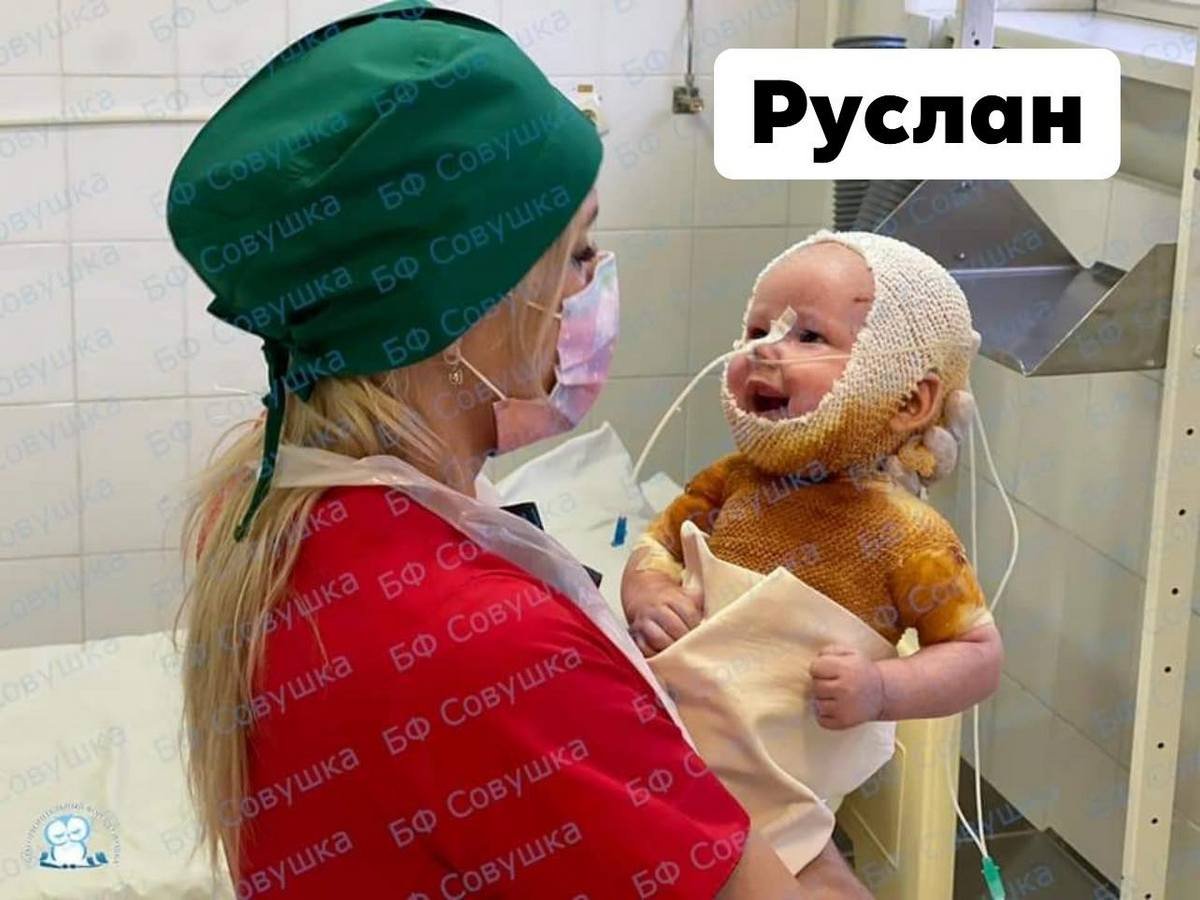 Обожглась в пожаре, пострадал при взрыве и вылетела через лобовое стекло: каким детям из Днепра нужна помощь 5