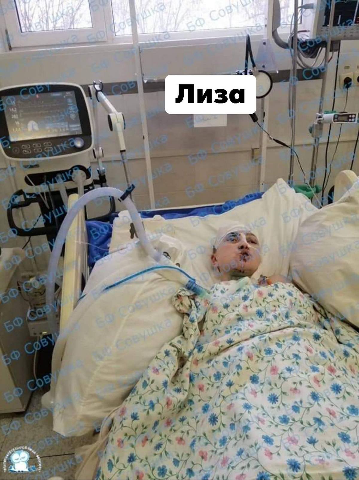 Обожглась в пожаре, пострадал при взрыве и вылетела через лобовое стекло: каким детям из Днепра нужна помощь 6