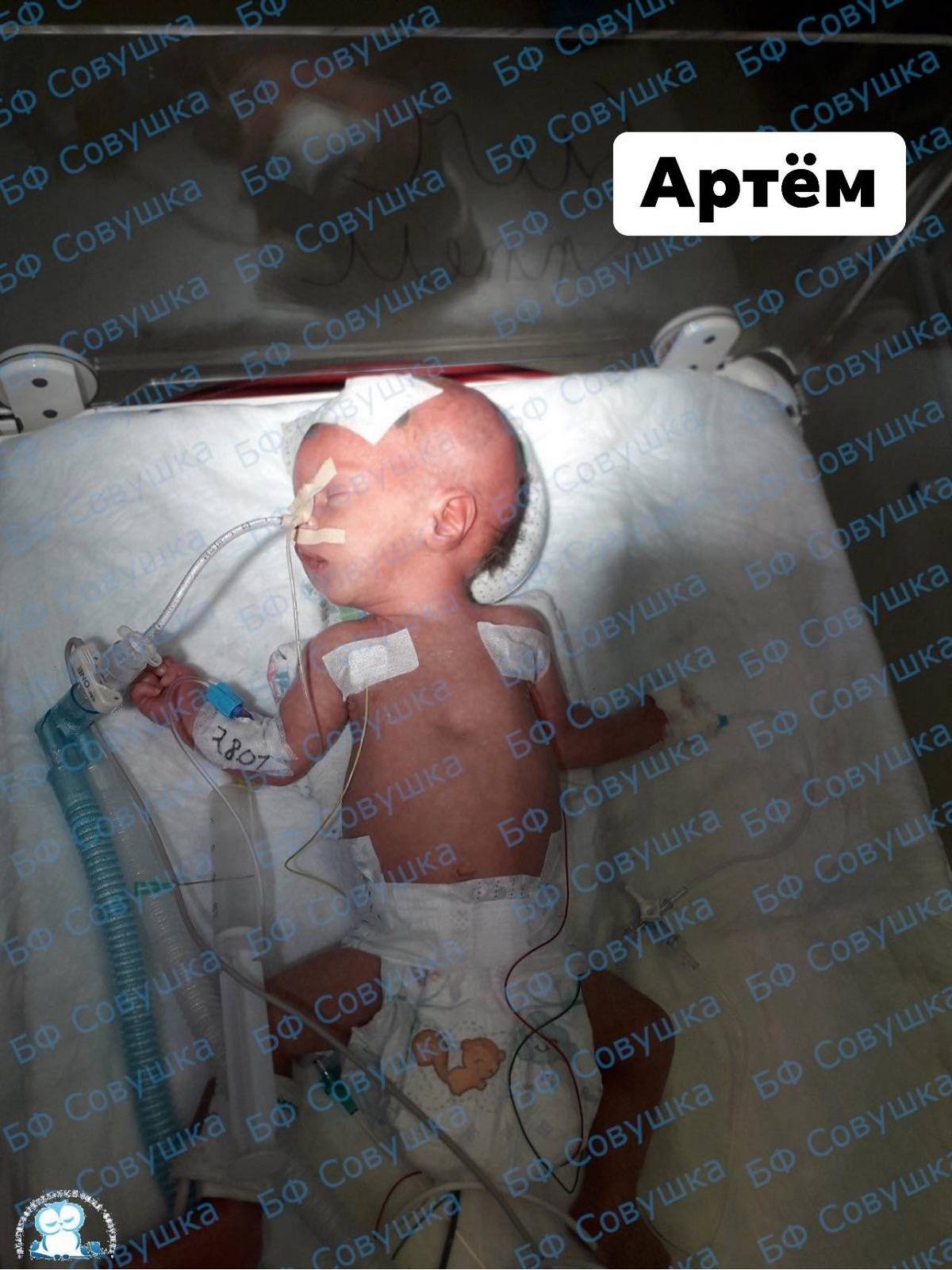 Обожглась в пожаре, пострадал при взрыве и вылетела через лобовое стекло: каким детям из Днепра нужна помощь 9
