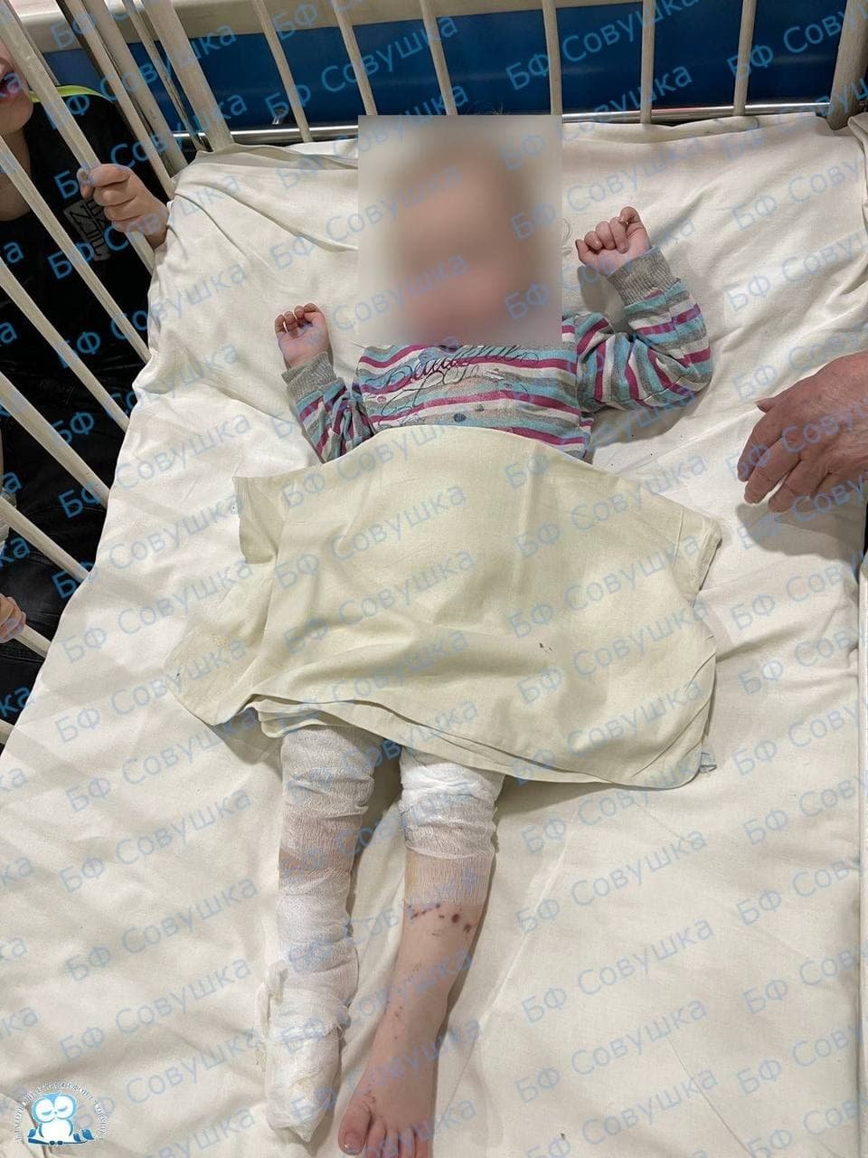 Девочки получили химические ожоги