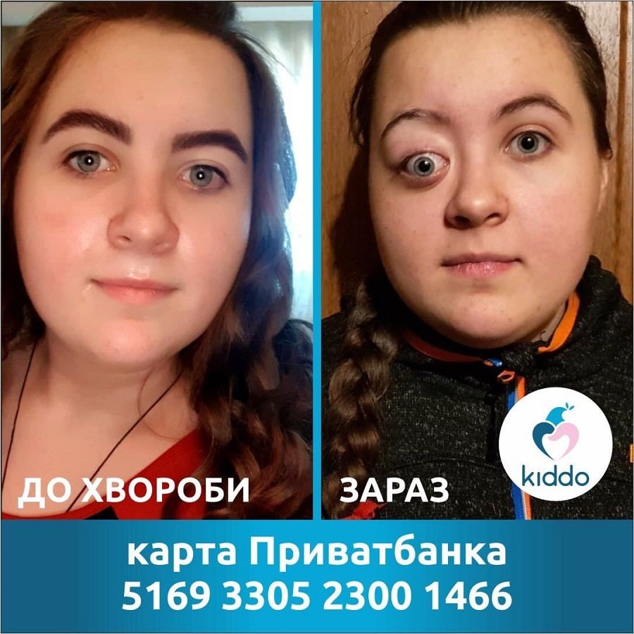 16-летняя Элина из Днепра нуждается в срочной операции: открыт сбор 1