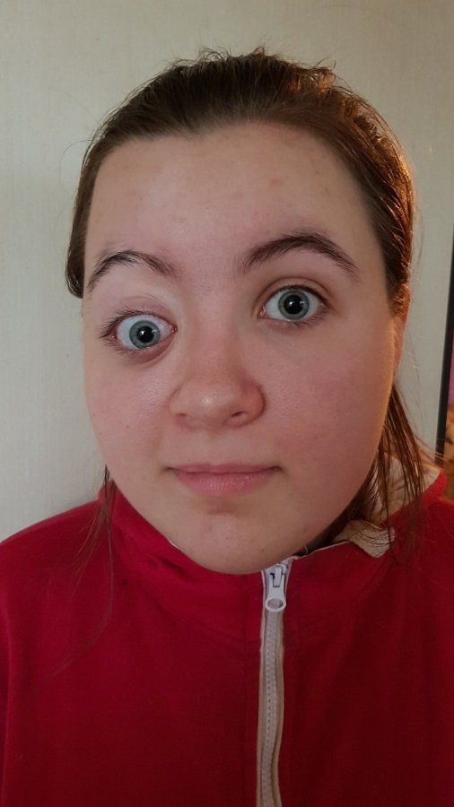 16-летней Элине из Днепра нужна срочная операция 2