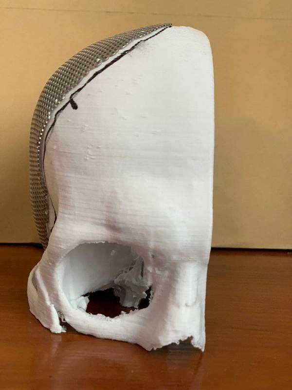 В больнице имени Мечникова уже проводили подобные операции