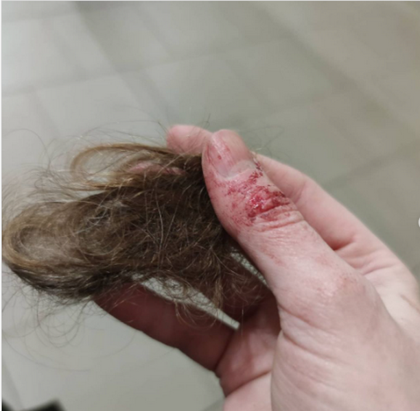 В Днепре таксист избил девушку в Международный женский день 1