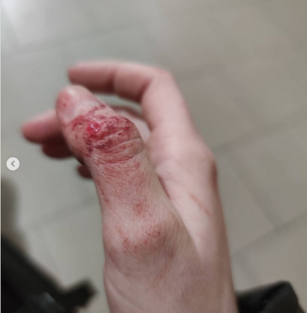 В Днепре таксист избил девушку в Международный женский день 2