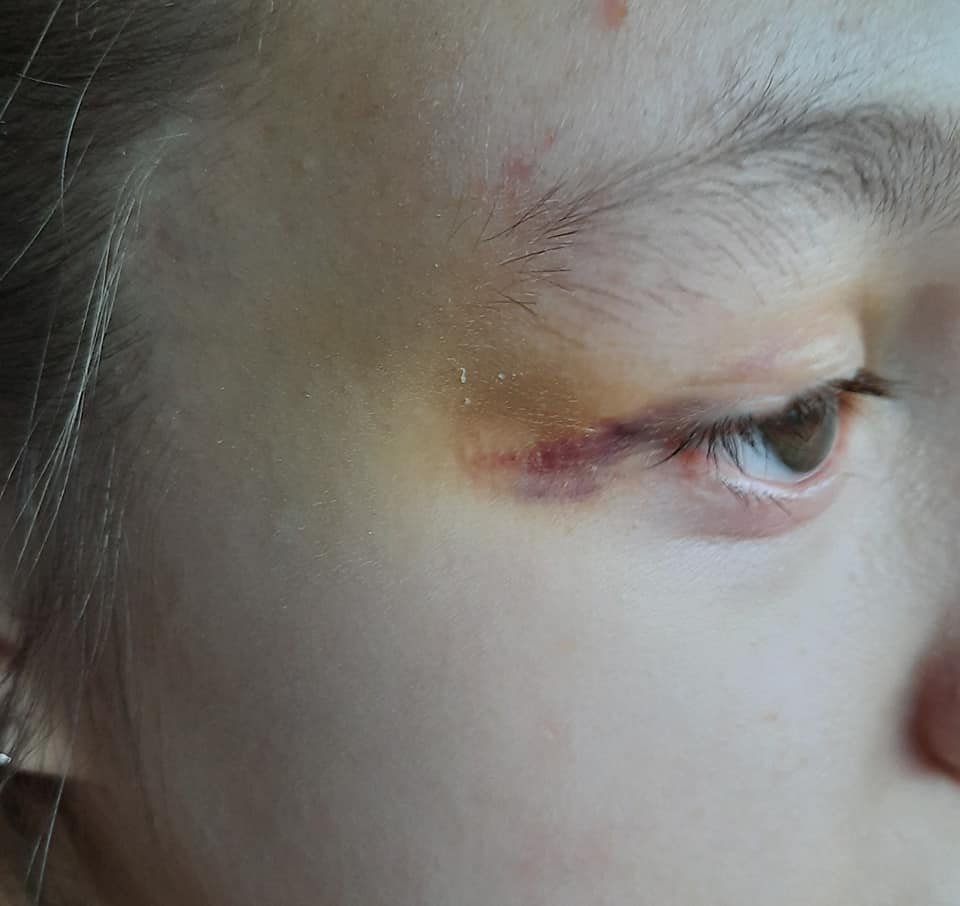 Ребенок пострадал