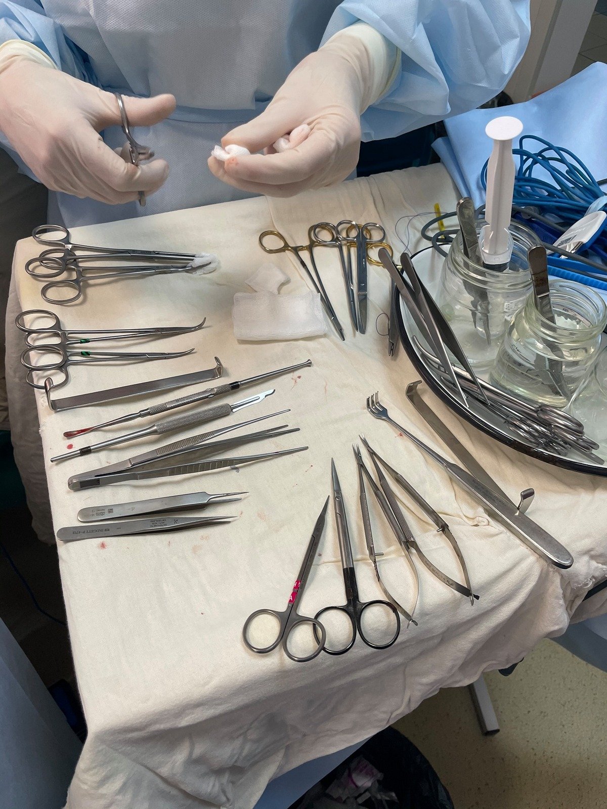 В Днепропетровской областной детской больнице провели уникальную операцию по удалению опухоли у новорожденного ребенка В Днепропетровской областной детской больнице провели уникальную операцию по удалению опухоли у новорожденного ребенка