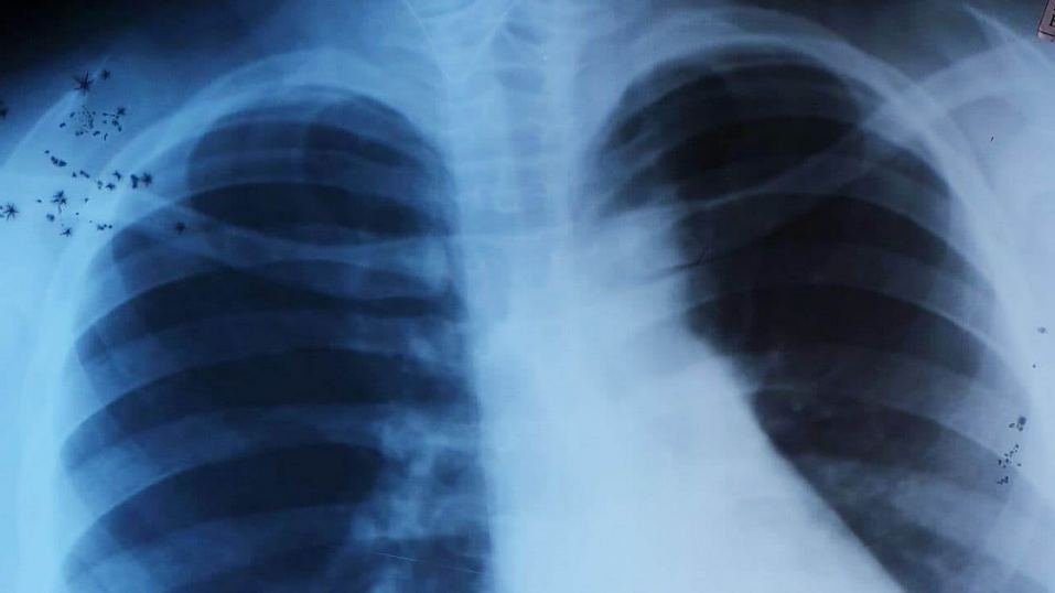 Девочка вдохнула кусочек обложки