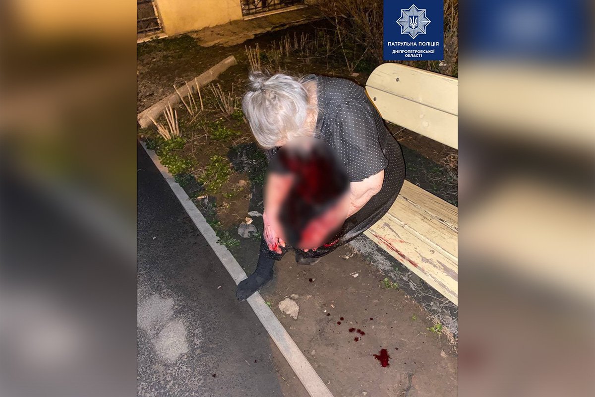 На проспекте Поля мужчина избил свою 77-летнюю мать, женщину забрала скорая