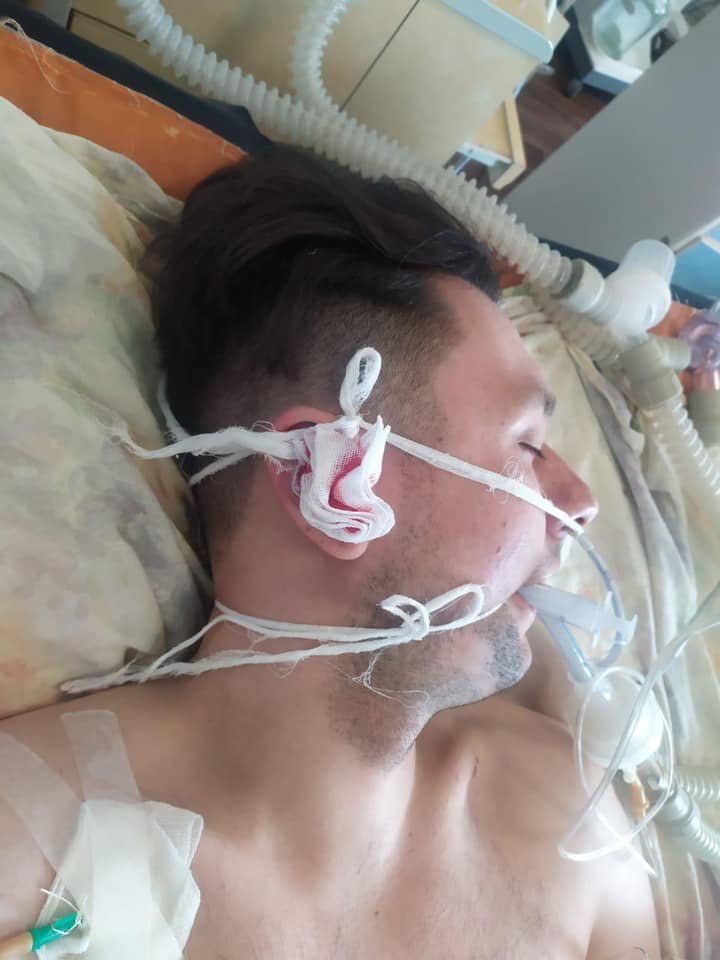 В Днепропетровской области избили мужчину и оставили на обочине трассы: нужна помощь в опознании 4