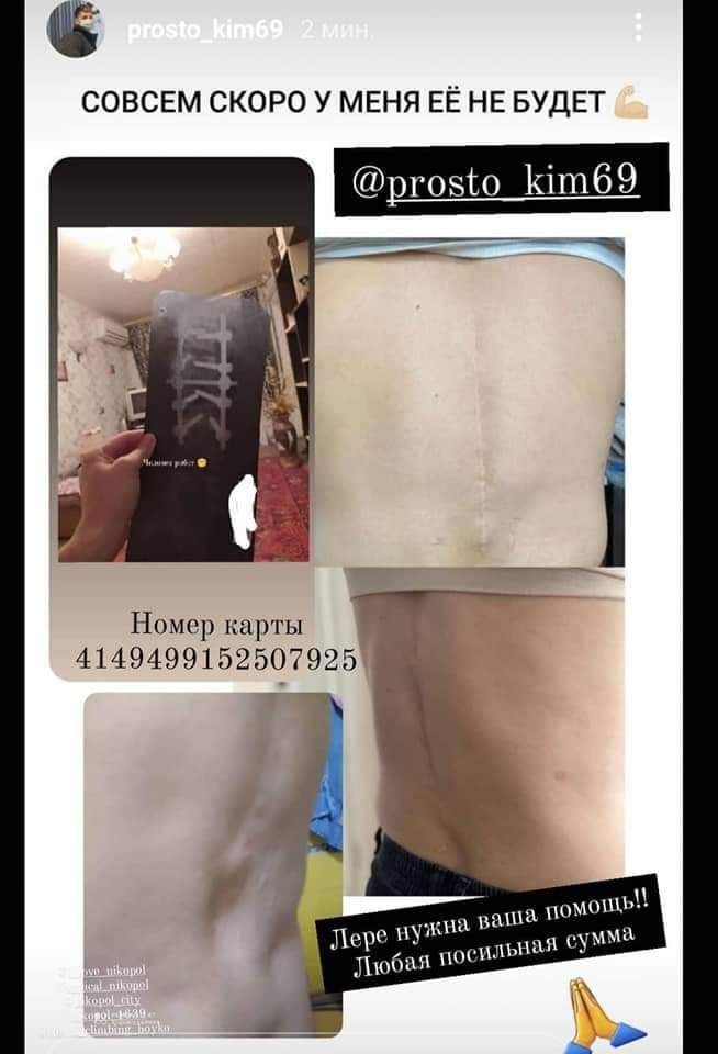 Участница шоу "Від пацанки до панянки" из Днепропетровской области готовится к серьезной операции 1