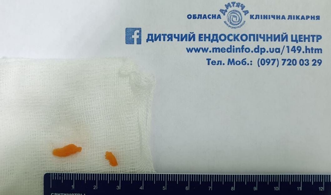 Ребенок подавился морковью