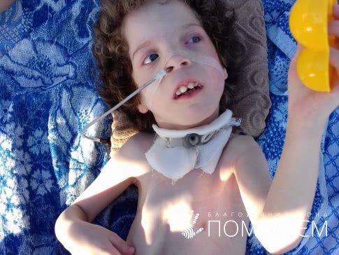 Лейкемия, муковисцидоз и лимфома: каким детям в Днепре нужна помощь 2