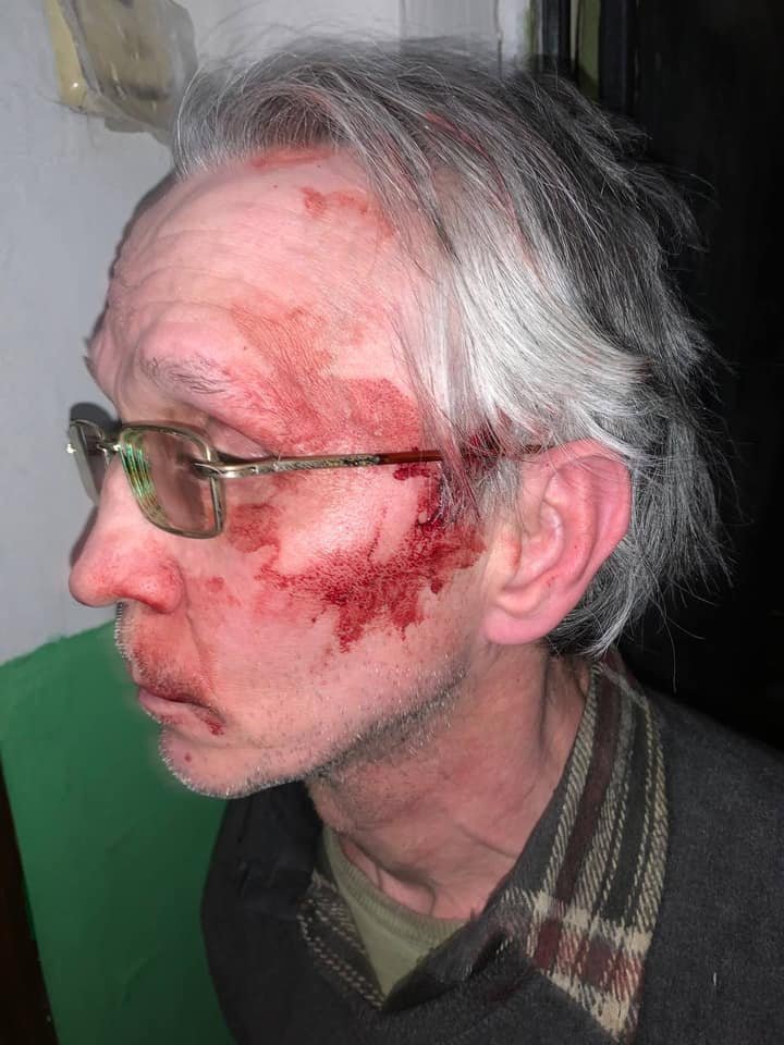 Мужчина получил травму головы Мужчина получил травму головы