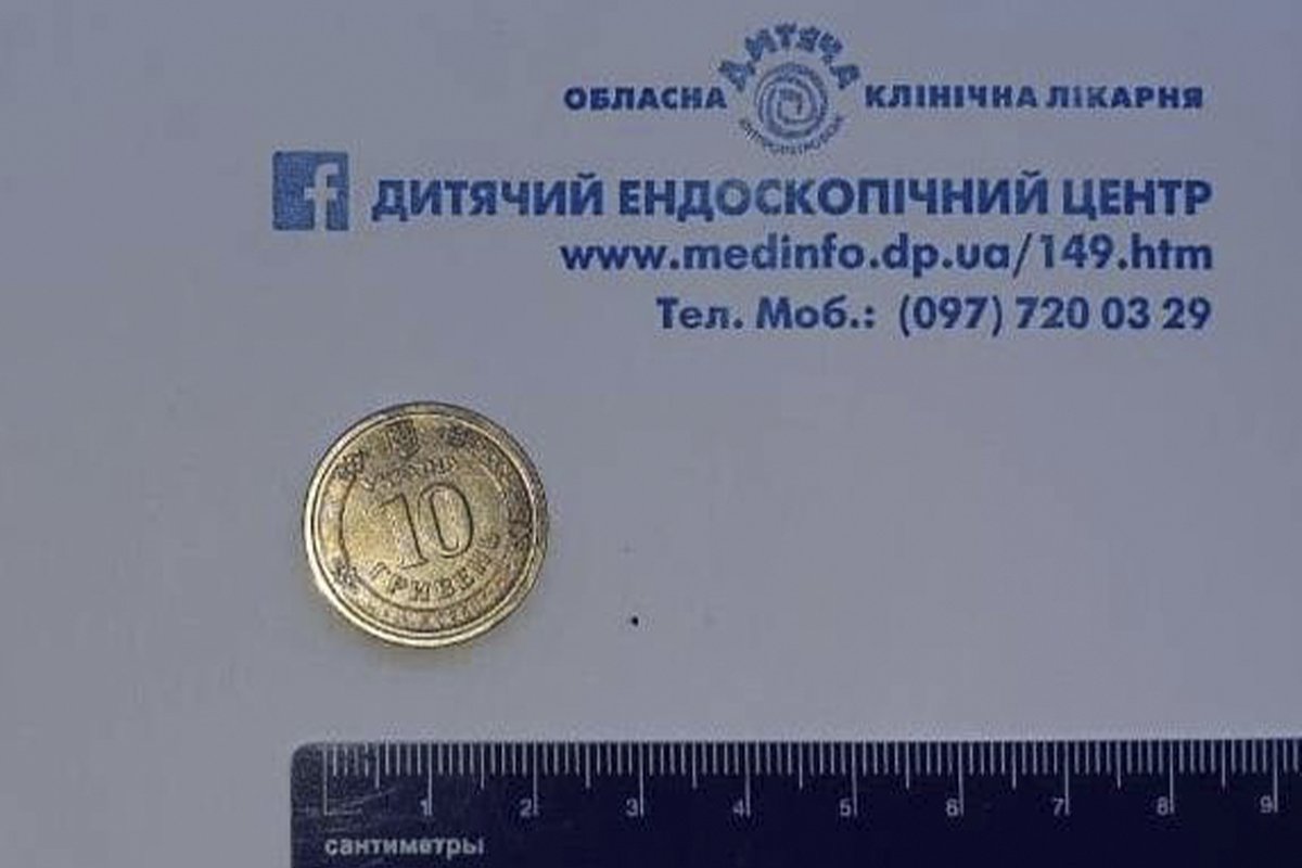 В Днепре 8-летний ребенок проглотил 10-гривневую монету В Днепре 8-летний ребенок проглотил 10-гривневую монету