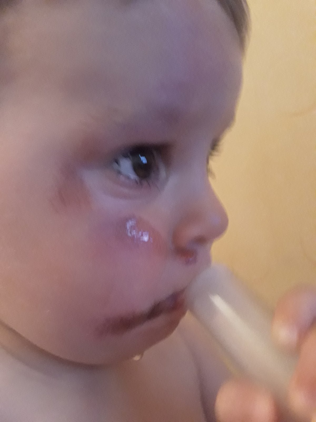 Серьезных травм не обнаружили Серьезных травм не обнаружили