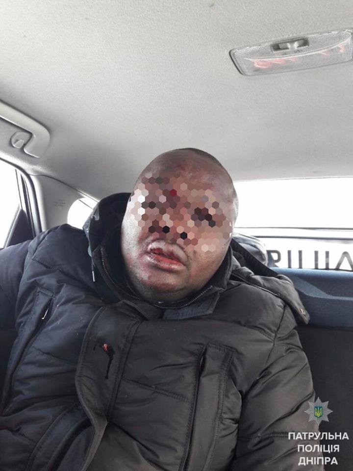 В Днепре напали на гражданина Франции (ФОТО) 2